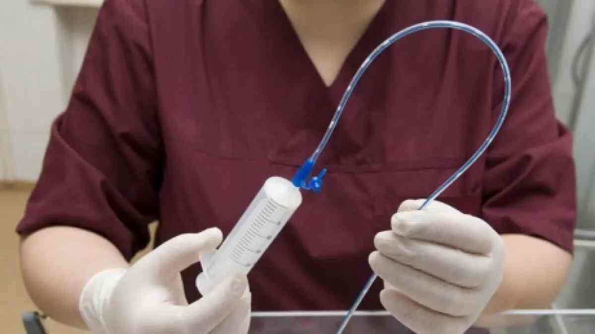 التغذية الانبوبية خطوات طبية لصحة المريض